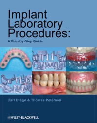 copertina di Implant Laboratory Procedures : A Step - by - Step Guide