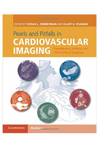 copertina di Pearls and Pitfalls in Cardiovascular Imaging - Pseudolesions, Artifacts, and Other ...