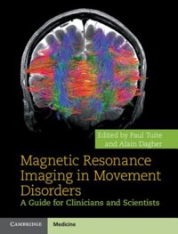 copertina di Magnetic Resonance Imaging ( MRI ) in Movement Disorders - A Guide for Clinicians ...