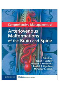copertina di Comprehensive Management of Arteriovenous Malformations of the Brain and Spine
