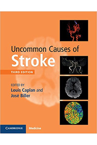 copertina di Uncommon Causes of Stroke