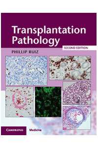 copertina di Transplantation Pathology