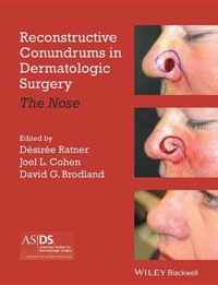 copertina di Reconstructive Conundrums in Dermatologic Surgery - The Nose