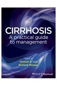 copertina di Cirrhosis - A Practical Guide to Management