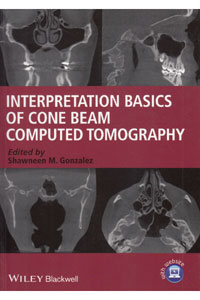 copertina di Interpretation Basics of Cone Beam Computed Tomography ( CT )