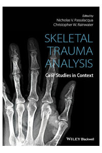 copertina di Skeletal Trauma Analysis: Case Studies in Context