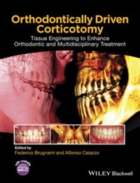 copertina di Orthodontically Driven Corticotomy - Tissue Engineering to Enhance Orthodontic and ...