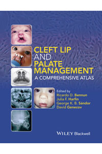 copertina di Cleft Lip and Palate Management: A Comprehensive Atlas