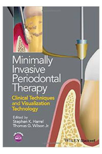 copertina di Minimally Invasive Periodontal Therapy: Clinical Techniques and Visualization Technology