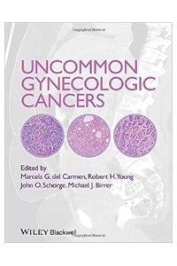 copertina di Uncommon Gynecologic Cancers