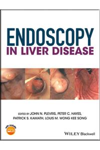 copertina di Endoscopy in Liver Disease