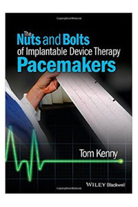 copertina di The Nuts and Bolts of Implantable Device Therapy: Pacemakers