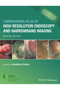 copertina di Comprehensive Atlas of High Resolution Endoscopy and Narrowband Imaging