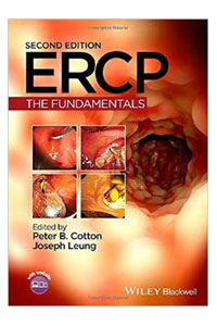 copertina di ERCP ( Endoscopic Retrograde Cholangio - Pancreatography ) : The Fundamentals