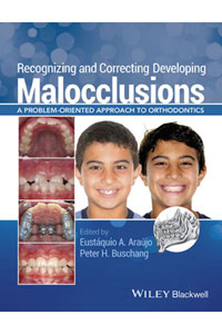 copertina di Recognizing and Correcting Developing Malocclusions: A Problem - Oriented Approach ...