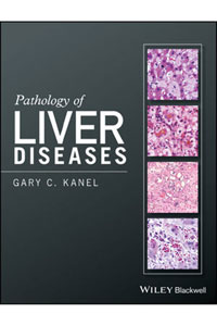 copertina di Pathology of Liver Diseases