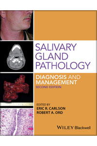 copertina di Salivary Gland Pathology: Diagnosis and Management