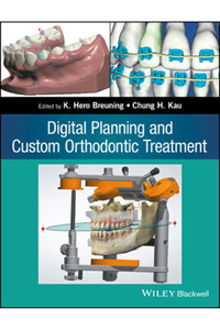 copertina di Digital Planning and Custom Orthodontic Treatment