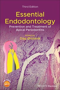 copertina di Essential Endodontology: Prevention and Treatment of Apical Periodontitis