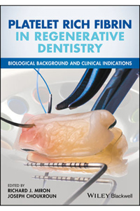 copertina di Platelet Rich Fibrin in Regenerative Dentistry: Biological Background and Clinical ...