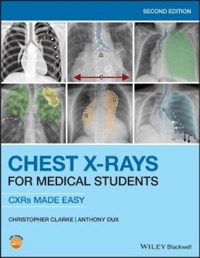 copertina di Chest X - rays for Medical Students: CXRs Made Easy