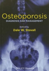 copertina di Osteoporosis: Diagnosis and Management