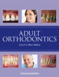 copertina di Adult Orthodontics