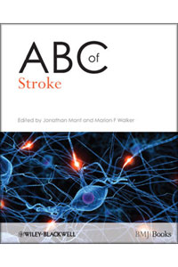 copertina di ABC of Stroke