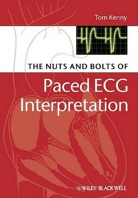 copertina di The Nuts and bolts of Paced ECG Interpretation