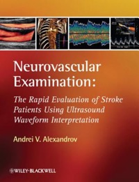 copertina di Neurovascular Examination: The Rapid Evaluation of Stroke Patients Using Ultrasound ...