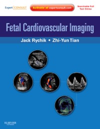 copertina di Fetal Cardiovascular Imaging : A Disease Based ApproachExpert Consult Premium Edition ...