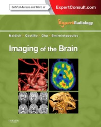 copertina di Imaging of the Brain - Expert Radiology Series