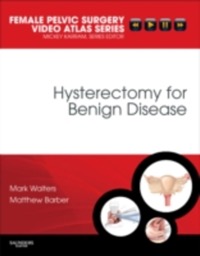 copertina di Hysterectomy for Benign Disease - Female Pelvic Surgery Video Atlas Series - DVD ...