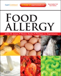 copertina di Food Allergy - Expert Consult Basic