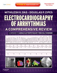 copertina di Electrocardiography of Arrhythmias : A Comprehensive Review - A Companion to Cardiac ...
