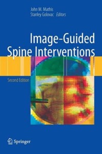 copertina di Image - Guided Spine Interventions