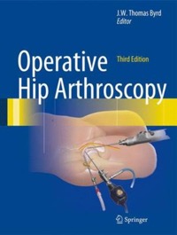 copertina di Operative Hip Arthroscopy