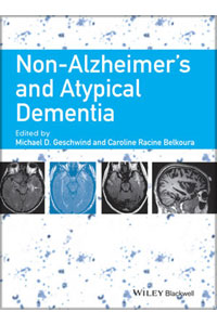 copertina di Non - Alzheimer' s and Atypical Dementia