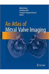 copertina di An Atlas of Mitral Valve Imaging