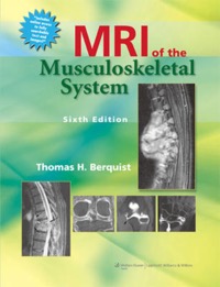 copertina di MRI ( Magnetic resonance imaging ) of the musculoskeletal system
