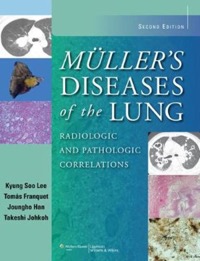copertina di Muller' s Diseases of the Lung - Radiologic and Pathologic Correlations