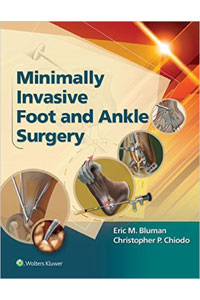 copertina di Minimally Invasive Foot and Ankle Surgery