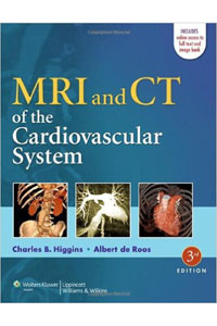 copertina di MRI ( Magnetic resonance imaging ) and CT ( Computed Tomography ) of the cardiovascular ...