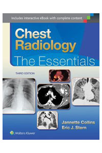 copertina di Chest Radiology - The Essentials