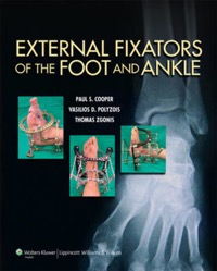 copertina di External Fixators of the Foot and Ankle