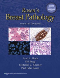 copertina di Rosen' s Breast Pathology