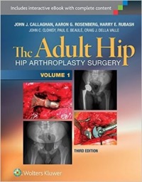 copertina di The Adult Hip : Arthroplasty and Its Alternatives