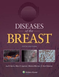 copertina di Diseases of the Breast