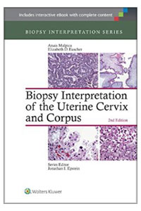 copertina di Biopsy Interpretation of the Uterine Cervix and Corpus