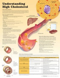 copertina di Understanding High Cholesterol Paper